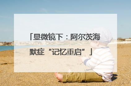显微镜下：阿尔茨海默症“记忆重启”